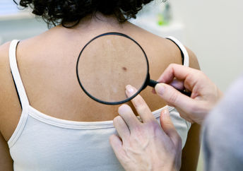 检查皮肤癌的皮肤癌探测机更容易。